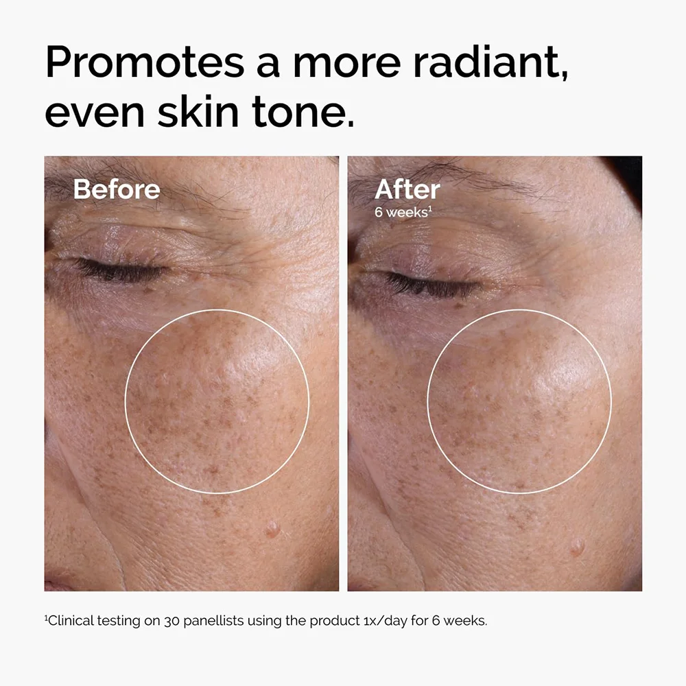 The Ordinary Glycolic Acid 7% Exfoliating Toner | Daily Brightening and Smoothing Skin Toner 2 The Ordinary Glycolic Acid 7% Exfoliating Toner | Daily Brightening and Smoothing Skin Toner - Image 2